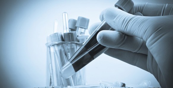 Primer mapa de resistencia humana al virus del sida