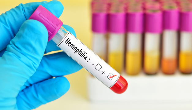 Hemofilia Vidasana