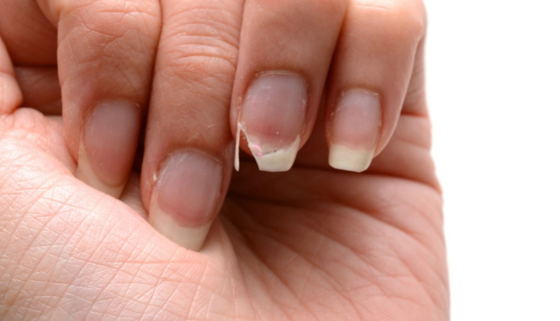 Guía fácil para fortalecer las uñas débiles y quebradizas