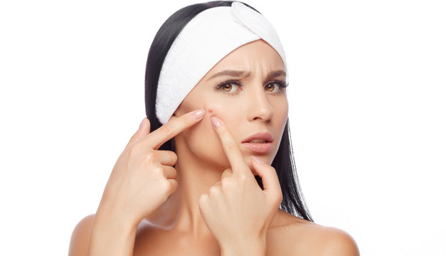 Cuídate del incómodo acné