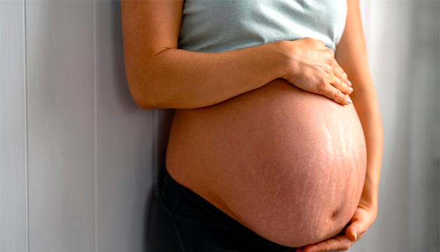 Evita las estrías durante el embarazo