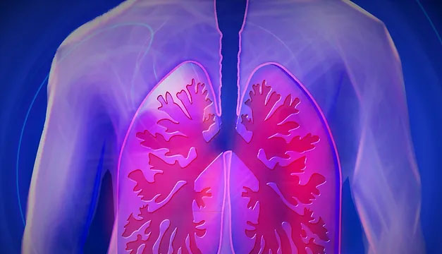 ¿Qué es la fibrosis quística? Conoce más aquí