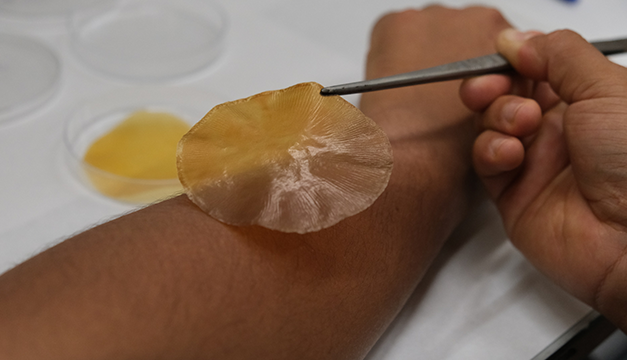 Investigadores crean vendaje que se activan con la luz solar para frenar las infecciones bacterianas